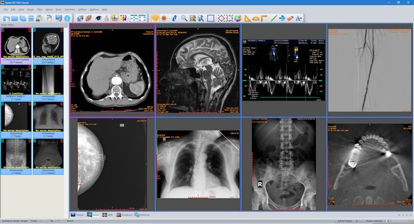 Sante  DICOM  Viewer(医疗办公软件)